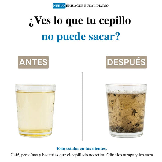 Sonriva® — Enjuague de Extracción Profunda